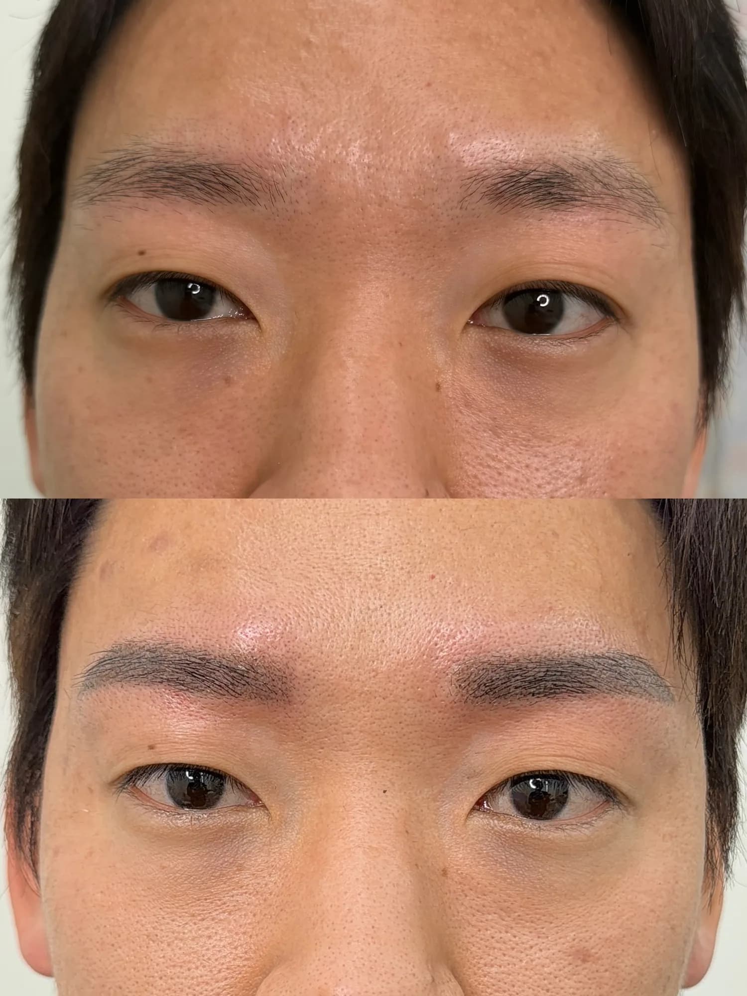 눈썹 시술 후 결과